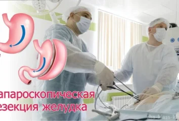 Прием бариатрического хирурга