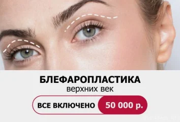 Блефаропластика верхних век